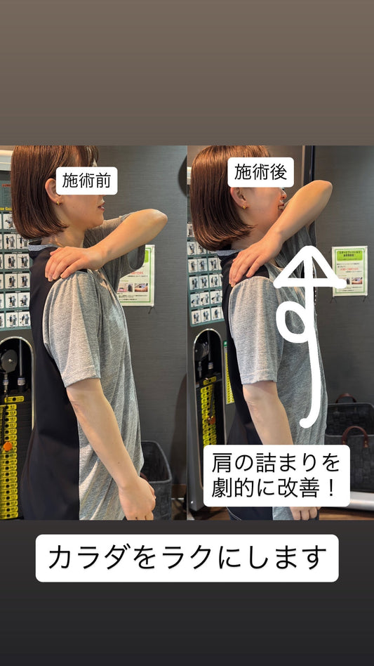 機能改善　ビフォーアフター